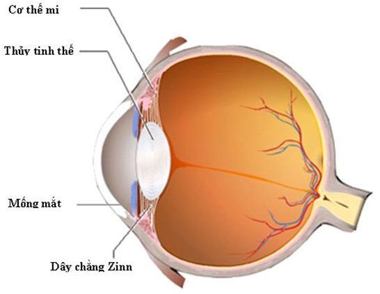 BỆNH ĐỤC THUỶ TINH THỂ VÀ NHỮNG ĐIỀU CẦN BIẾT